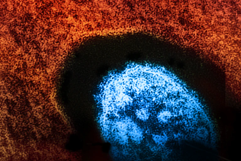 Colourized microscopic view of the measles virus in blue
