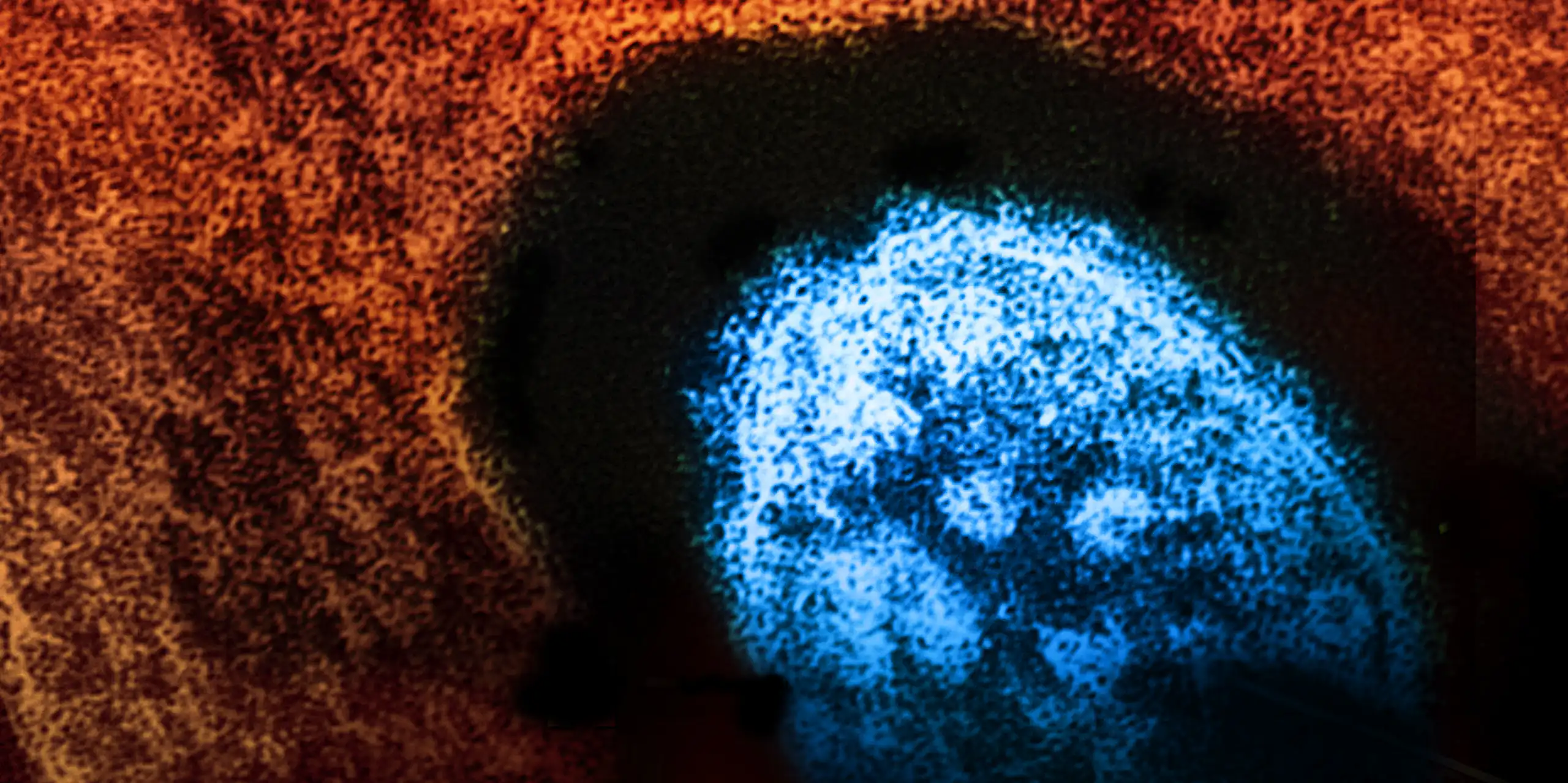 Colourized microscopic view of the measles virus in blue