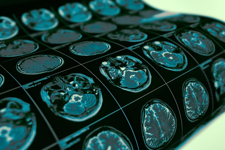 Several brain scans as part of a medical diagnostic process.