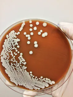 A petri dish with the bacteria _B. pseudomallei_.