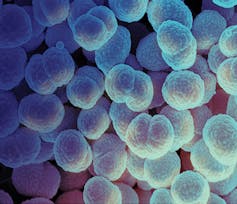Blue, rounded bacteria with bumpy surface