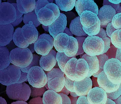 Blue, rounded bacteria with bumpy surface