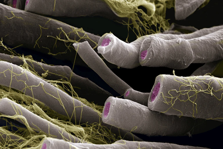 Array of long, thick tubes with their ends cut off to reveal a pink center, all tangled in a gossamer-like material