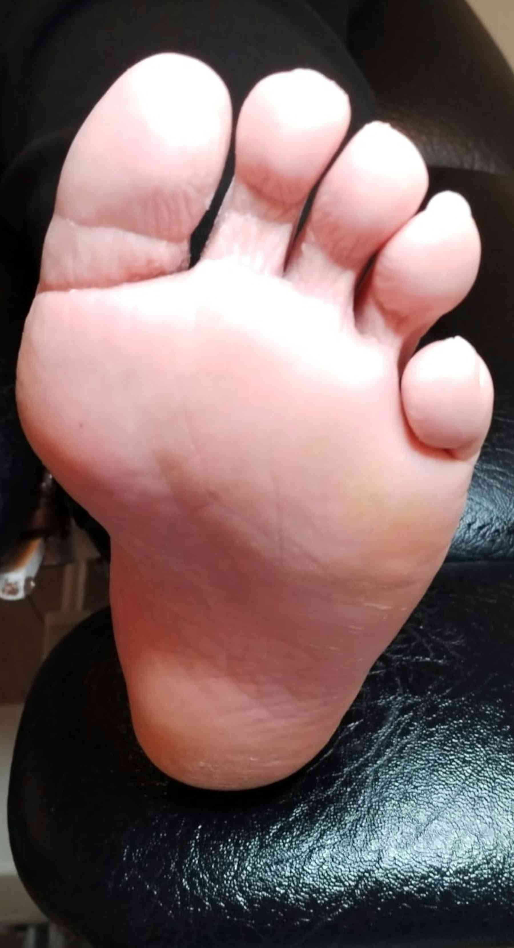 Why you should check for ‘Irish pinky toe’ – and what to do if you have one