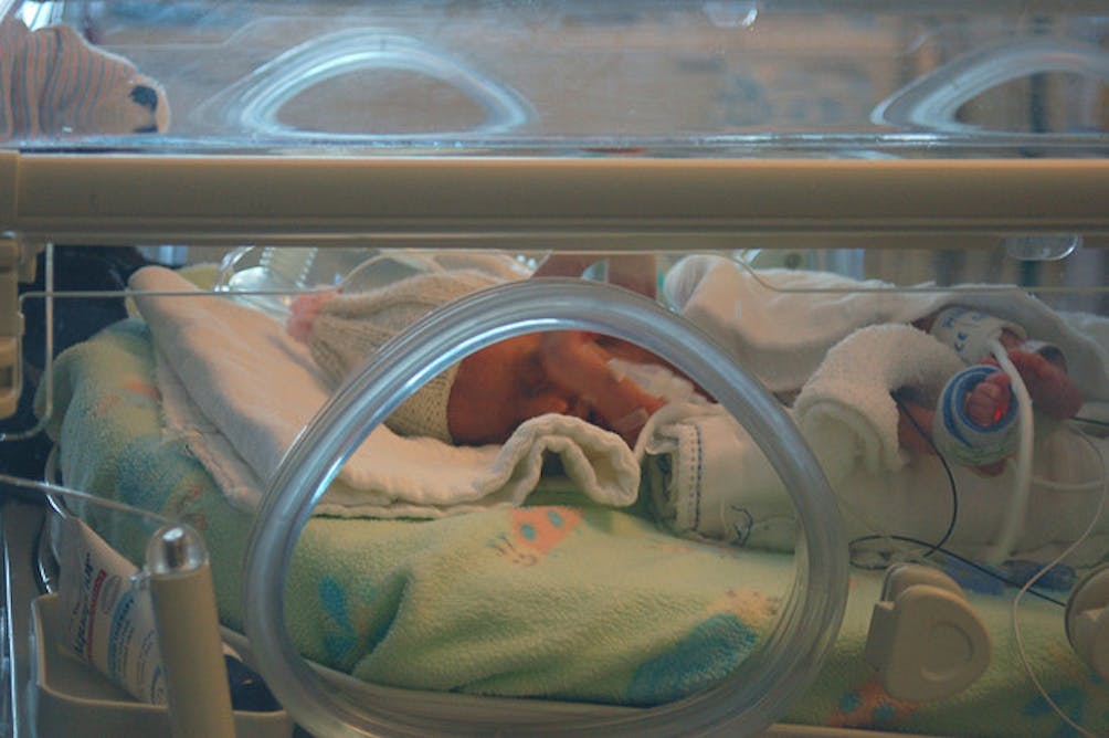 premature babies 24 weeks