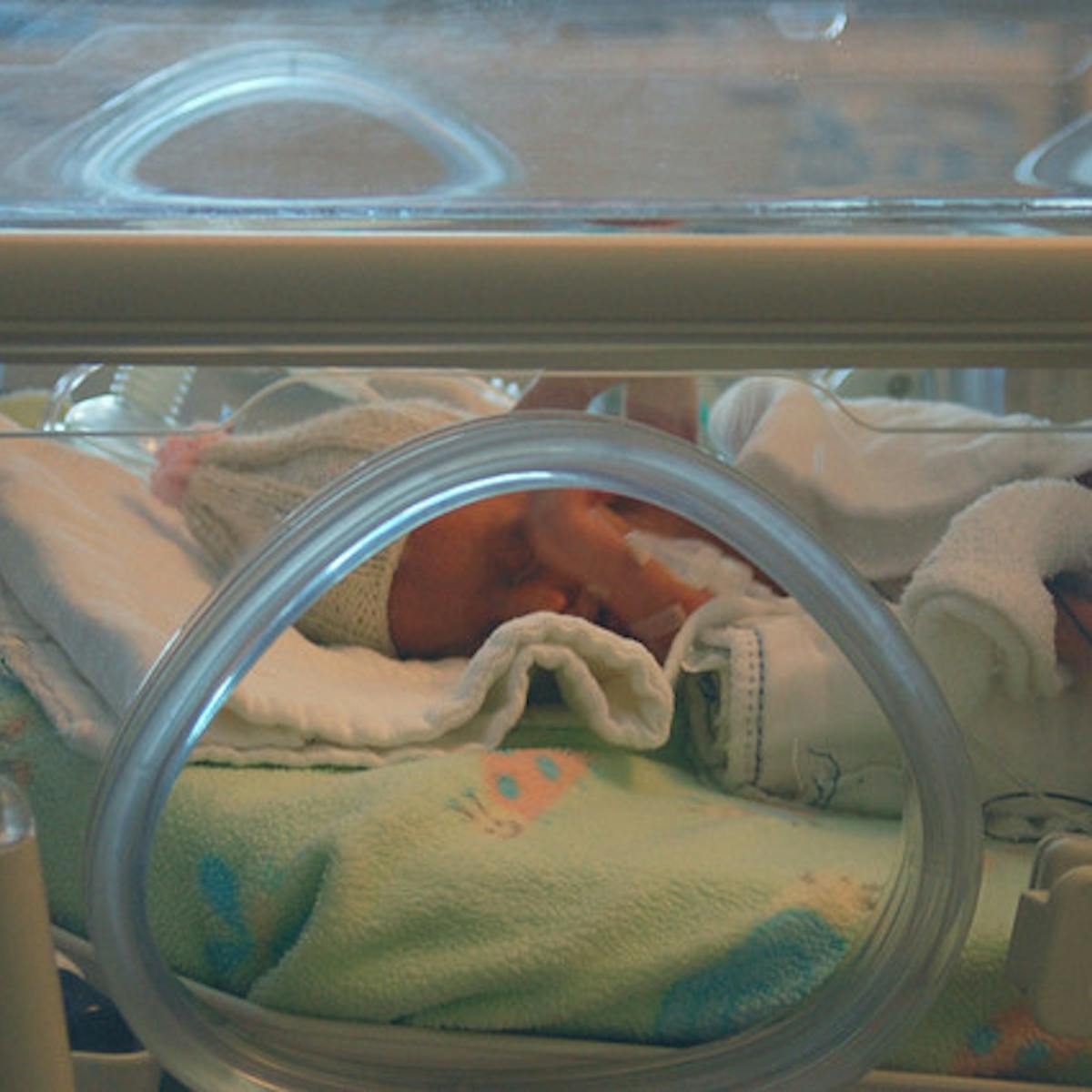 Balancing Hope And Fear For Babies Born At 24 Weeks Gestation Balancing Hope And Fear For Babies Born At 24 Weeks Gestation
