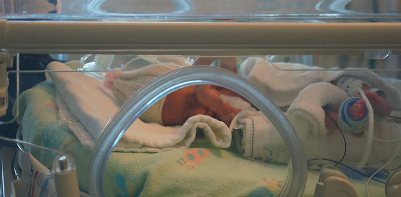 Balancing Hope And Fear For Babies Born At 24 Weeks Gestation Balancing hope and fear for babies born at 24 weeks gestation