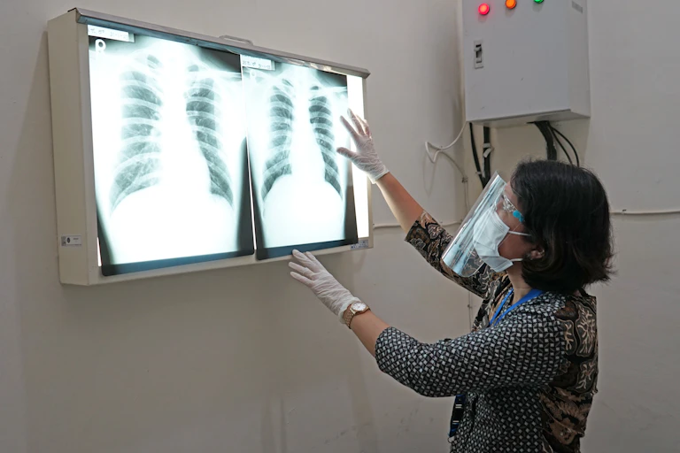 A medical person examining two X-rays mounted on a lightbox.