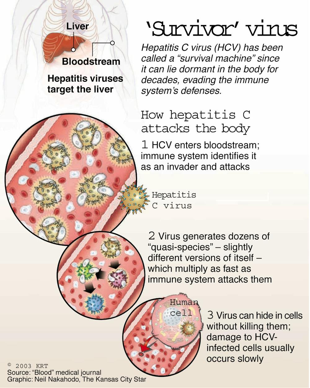készítmények kezelésére hepatitis c diabetes a cukorbetegség jelei