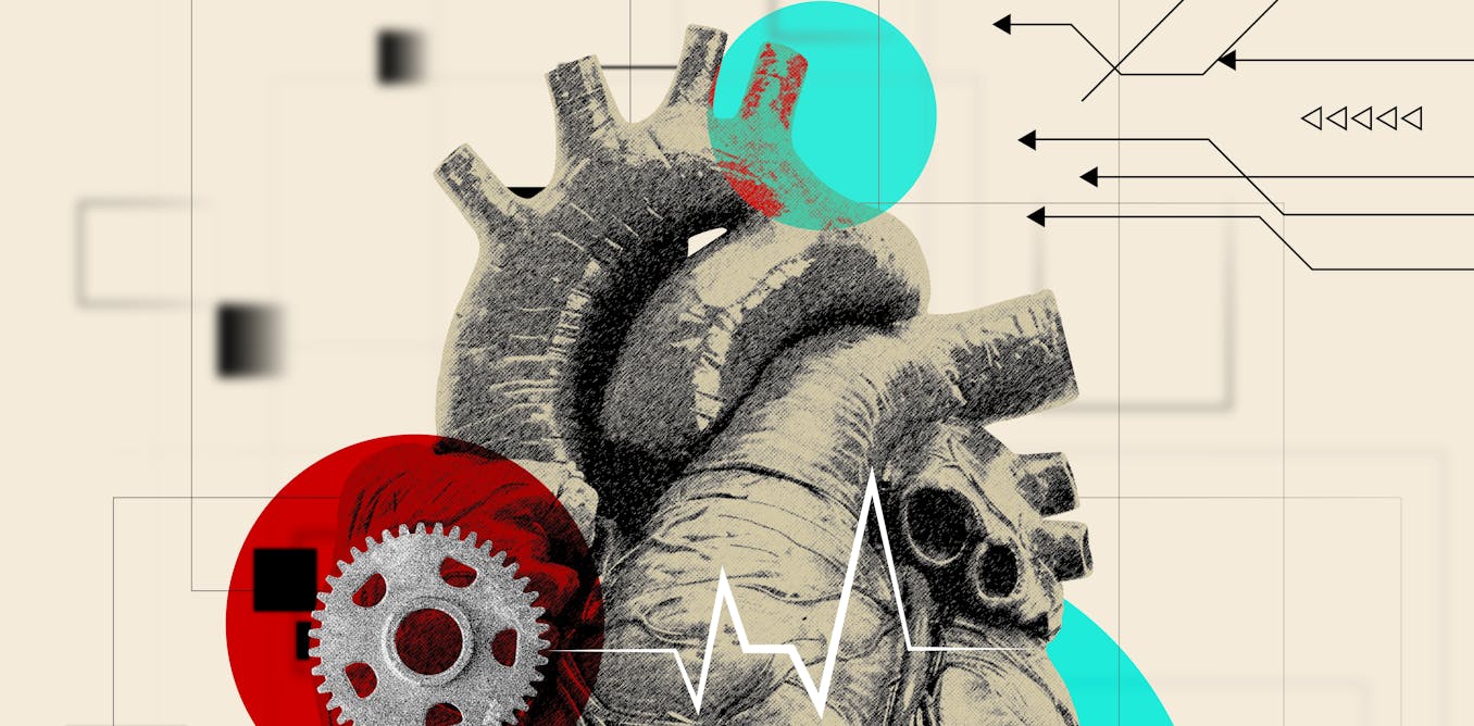 An artificial heart may save your life. But it can also change you in surprising ways