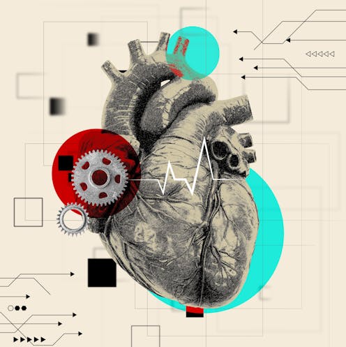 An artificial heart may save your life. But it can also change you in surprising ways