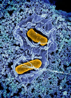 Imagen microscópica Dos barras de naranja integradas en la superficie azul de forma incorrecta