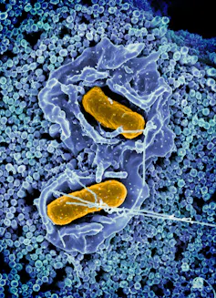 Microscopy image of two orange rods embedded in an irregularly shaped blue surface