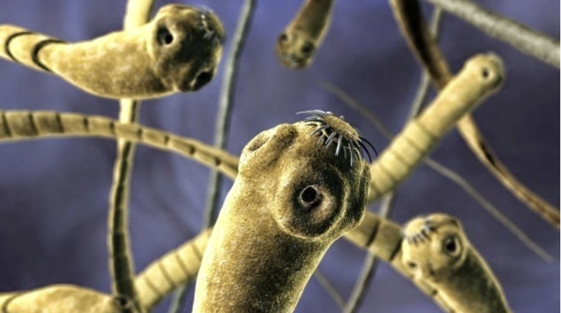 O mundo oculto e perigoso dos vermes parasitas – como identificar os sinais  incomuns, image size:1356x668