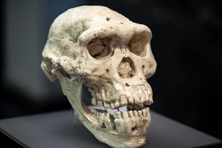 Fossil face discovery highlights demanding situations confronted by way of Europe’s earliest settlers 2 Dmanisi skull 5