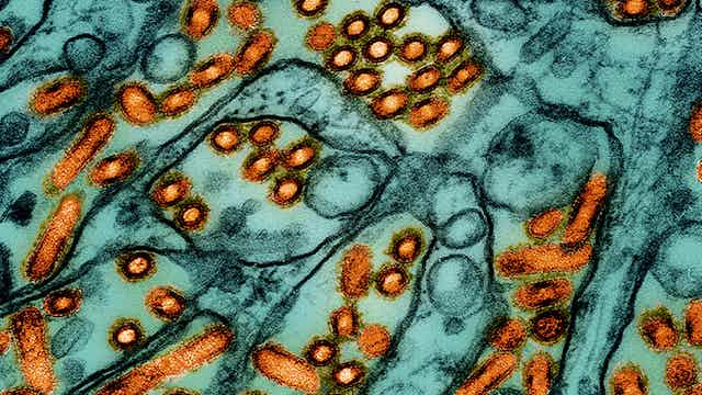 Microscopic view of avian influenza A H5N1 virus particles
