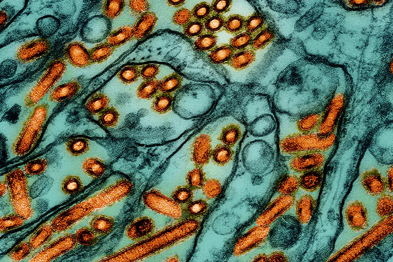 Microscopic view of avian influenza A H5N1 virus particles