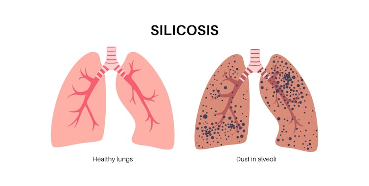 1 in 10 tunnel workers could develop silicosis, our new research shows