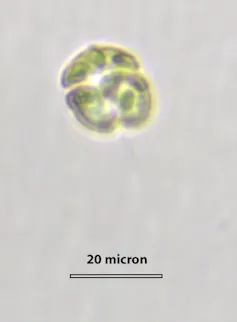 The harmful microalgae species under the microscope, showing a few blurry green single-celled organisms