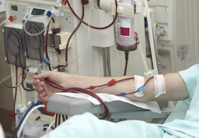 A dialysis machine at work, with lines into a patient's arm