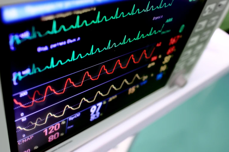 Computer monitor displaying vital signs and other patient information.