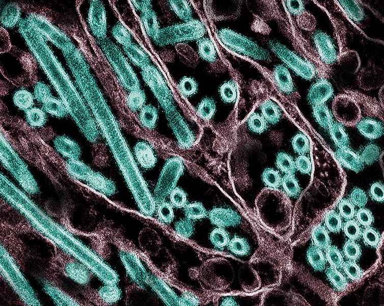 ¿Por qué es este un momento crítico para restaurar a Canadá su compromiso con la cooperación de salud global? 1 Visualización microscópica de color de circuitos azules y varillas en matrices moradas