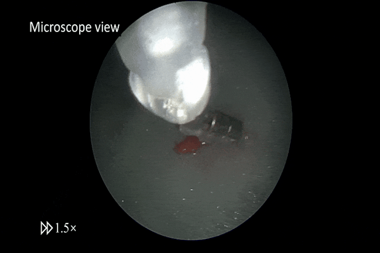 Microscope video showing tiny grippers picking up a lump of raspberry.