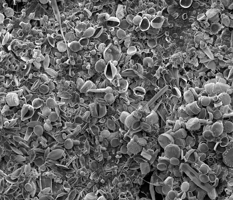 microbes under microscope