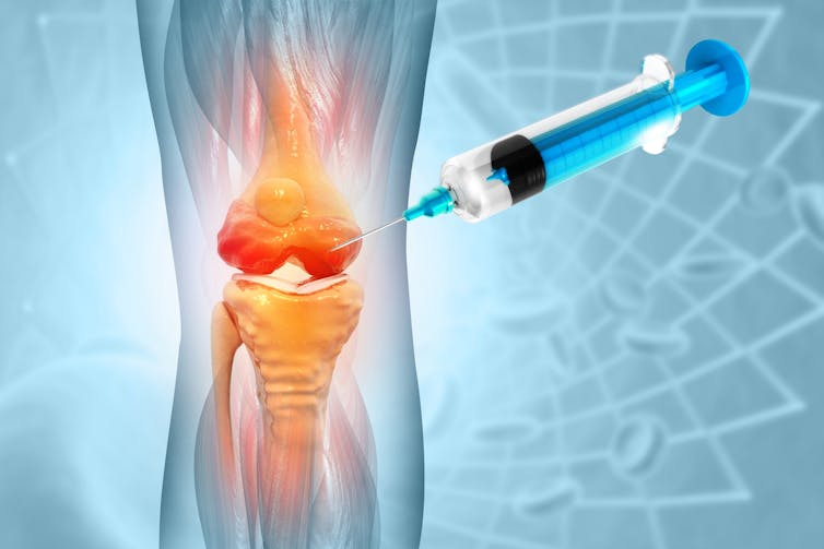 An illustration of an injection and a knee joint.