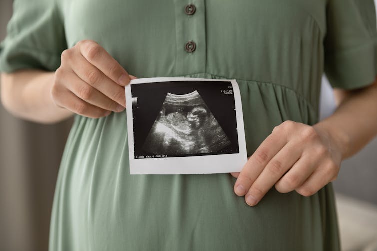The woman has an ultrasound image
