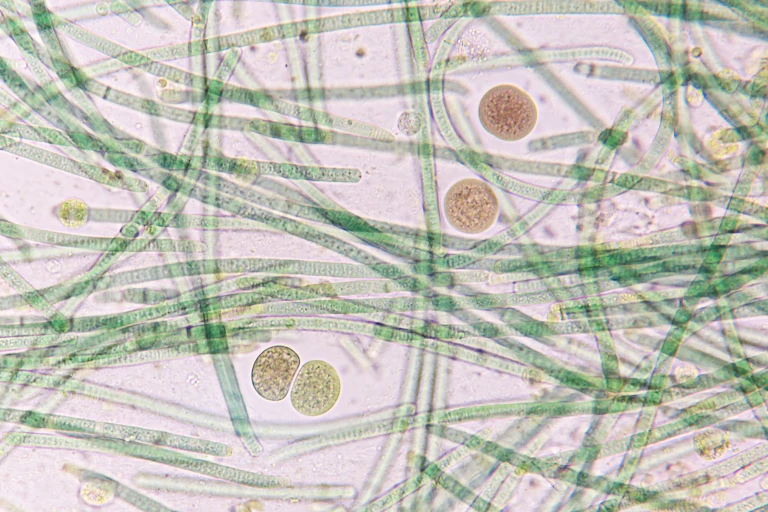 Microscopic image of lots of green lines and four brown circles.