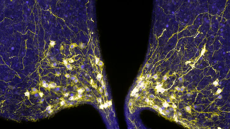 A photo of a scan of the active hypothalamic hunger-promoting neurons in a mouse's brain.