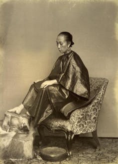 A Chinese woman with bound feet.