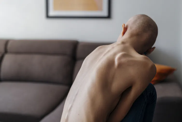 Close-up of a person's skeletal back and bald head from behind