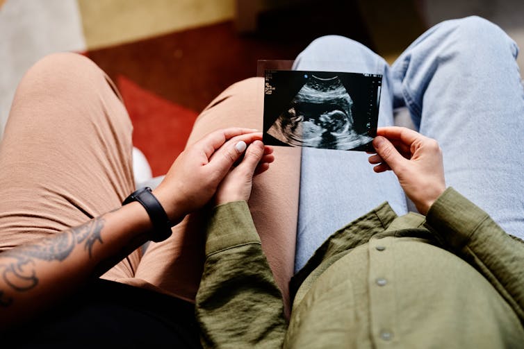 A couple holding an ultrasound photo.
