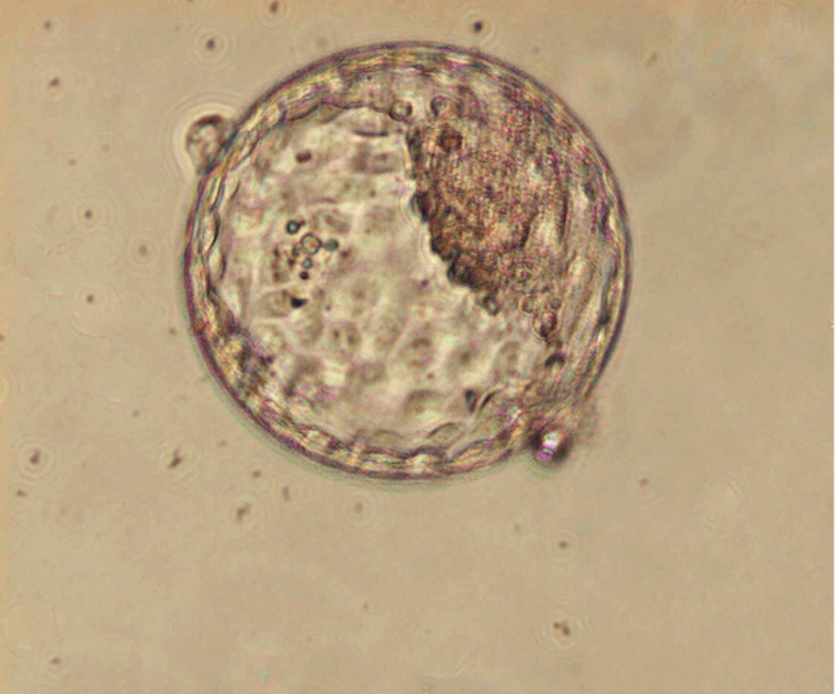 Standing of embryos and fetuses in France: Easy methods to anti-IVG and anti-choices cloud numbers 1 Photograph of the embryo in the blastocist stadium, five days after fertilization
