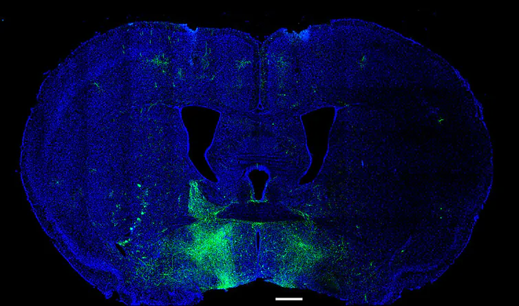 Microscopy image of mouse brain cross-section with lower middle-half dusted green