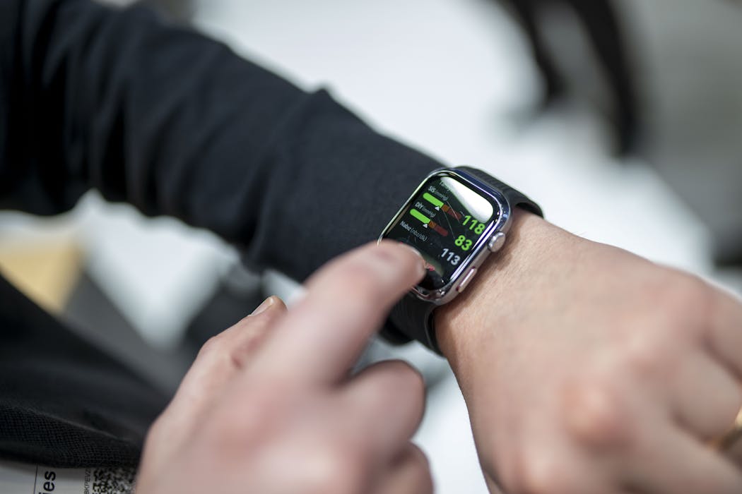 Smartwatches promise all kinds of quality-of-life improvements − here are 5 things users should keep in mind