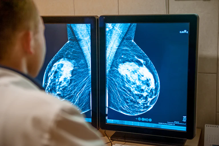 A doctor looks at mammography images on screens.