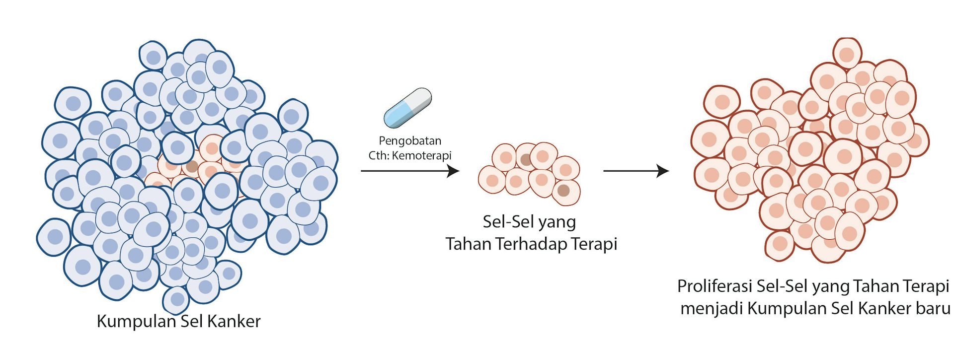 Perbedaan respons terhadap terapi memungkinkan sebagian sel kanker bertahan, tumbuh kembali, dan picu kambuhnya penyakit.