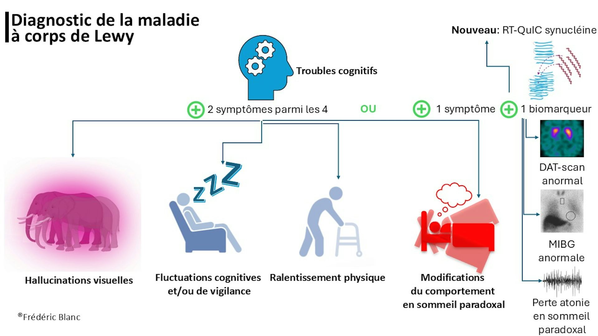 Schéma présentant l’établissement du diagnostic de la maladie à corps de Lewy