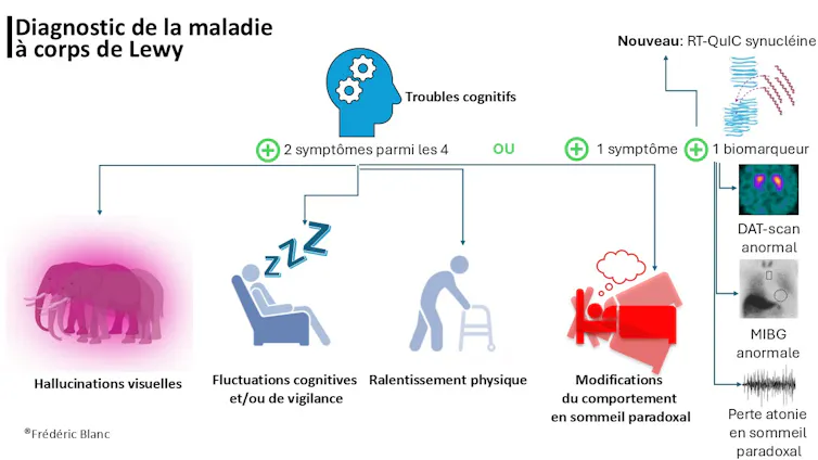 Schéma présentant l’établissement du diagnostic de la maladie à corps de Lewy