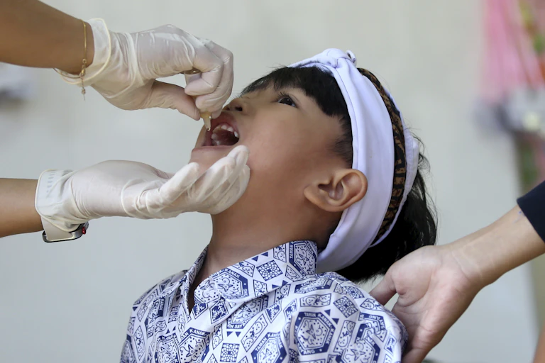 Close-up of a child tilting their head back while gloved hands use a dropper to put a drop of oral vaccine in the child's mouth