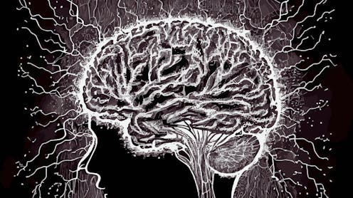 this brain disorder is more common than multiple sclerosis – but often goes undiagnosed