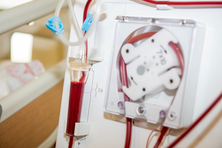 A close up of a kidney dialysis machine.