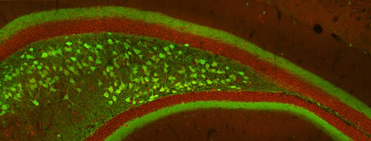 Section of mouse hippocampus.