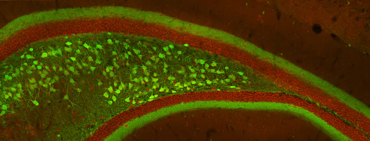 Section of mouse hippocampus.