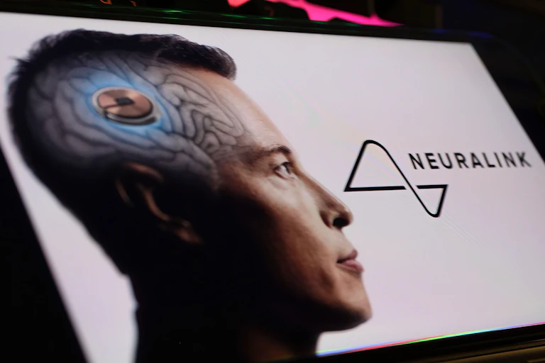 A man wears a brain implant.