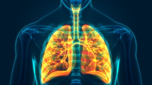 Lung cancer screening is about to start. What you need to know if you smoke or have quit