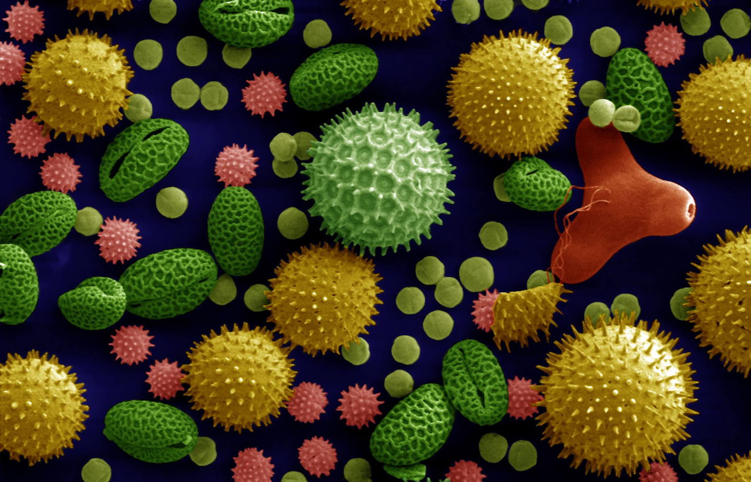 Many pollen grains, large and small, most of them round with spikes, but some oblong.